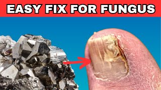 This Rare Mineral Cures Toenail Fungus [upl. by Berkie]