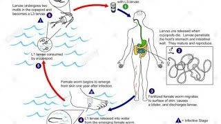 Dracunculus medinensis Guinea worm شرح دودة غينيا المسببة لداء التنينات لدكتورة نرمين خاليد [upl. by Ennaeus]