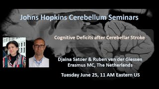 Djaina Satoer and Ruben van der Giessen Cognitive Deficits after Cerebellar Stroke [upl. by Eissolf]