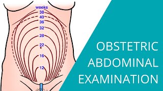 Obstetric Abdominal Examination  Steps for examining a pregnant woman [upl. by Nnaxor]