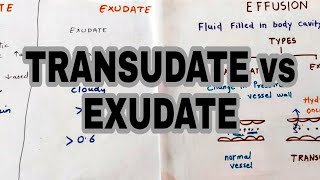 Pleural Effusions [upl. by Desi]