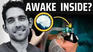 Exposed Surprising Brain Activity During Surgery [upl. by Neukam828]