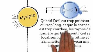 Myopie symptômes et traitement [upl. by Rotman]