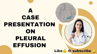 case presentation on pleural Effusion pleuraleffusion casepresentation subscribe nursingstudent [upl. by Aloeda]