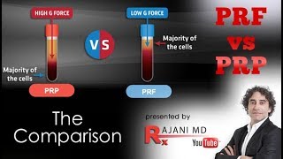 PRF vs PRP We Compare [upl. by Nawak397]