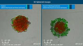 Monitoring and Quantifying 3D Tumor Spheroid Drug Cytotox by RTCA eSight Live Cell Analysis System [upl. by Ailhad356]