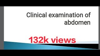 Abdomen  Clinical Examination [upl. by Ause616]