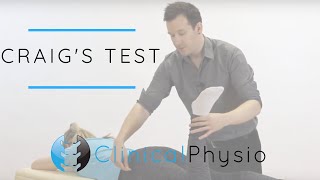 Craigs Test for Hip  Clinical Physio Premium [upl. by Kirtap]