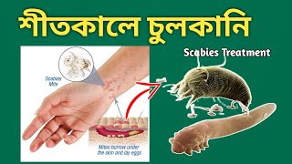 Scabies চুলকানির চিকিৎসা [upl. by Ermina212]