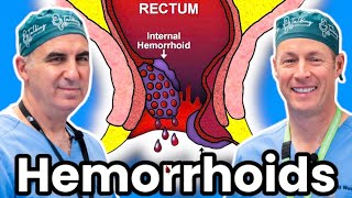 The Ultimate Treatment For Hemorrhoids [upl. by Neelloj631]