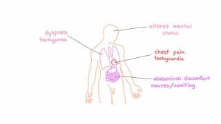 Signs and symptoms of hypoxemia [upl. by Tremain578]