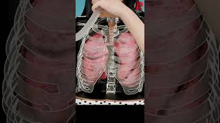 The Truth About Incentive Spirometry Doctor Explained [upl. by Antin]