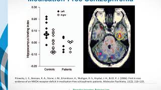 Causes of Schizophrenia Glutamate and the Glutamate Hypothesis [upl. by Aryan]