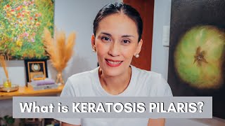 What is Keratosis Pilaris and how to Treat it  Dr Gaile RobredoVitas [upl. by Sabec134]