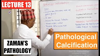 General Pathology Lecture 13  Pathological Calcification [upl. by Lleon]