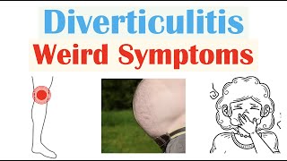 Weird Symptoms of Diverticulitis  Atypical Clinical Features of Diverticulitis [upl. by Ereveneug962]