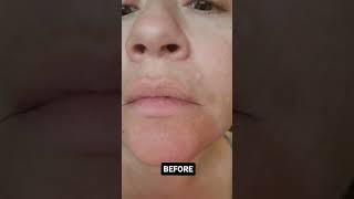 👄 GET RID OF DRY LIPS INSTANTLY 💋 liptreatment instantresults beforeandafter [upl. by Nitsyrc]