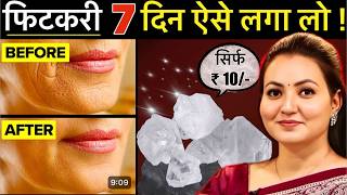 10 रूपए की चीज़ से Skin की सारी मुश्किल आसान  Facial Hair झाइयाँ Hyperpigmentation Wrinkles amp More💕 [upl. by Christy]