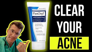 Doctor explains how to use BENZOYL PEROXIDE for ACNE aka PanOxyl  Acnecide  Side effects amp more [upl. by Federica]