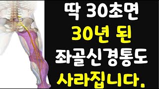 30초만에 방사통 일명 좌골신경통 즉시 없애주는 기가 막히는 운동 [upl. by Lucina]