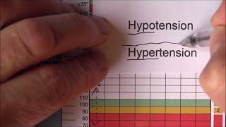 National Early Warning Score 2 Highs and lows [upl. by Noloc]