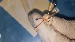 introduction to Endodontics obturation practical عربي [upl. by Pontone]