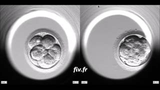 Evolution de deux embryons dans un Embryoscope [upl. by Eisseb]