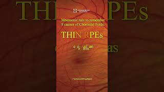 Choroidal Folds THIN RPEs Mnemonic rule to remember 8 causes [upl. by Farica]