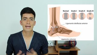 ESGUINCES  Clasificación  Definiciones [upl. by Charlot]