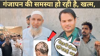 मेरठ की ऐसी जगह जहां लोगों की। गंजेपन की समस्या हो रही है खत्म hair fall problem solve [upl. by Nohsad]