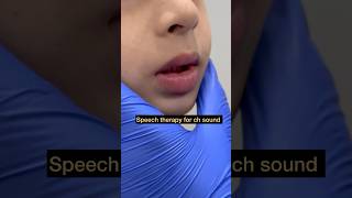 Speech Therapy  Articulation ch Sound  Tongue Positioning  Mis articulation  Teach Sound [upl. by Razal]