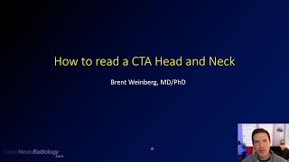 How to read a CT angiogram CTA of the Head and Neck [upl. by Heinrike312]