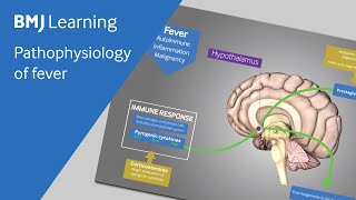 Pathophysiology of fever explained [upl. by Siuoleoj]