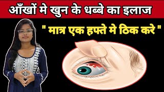 Sub Cunjuctiva Hemorrhage Treatment  Ankho Me khun ke Lal Dhabbe Ka Ilaz  In Hindi [upl. by Gierc870]