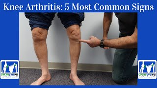 Knee Arthritis 5 Most Common Signs You Have It [upl. by Adyaj]