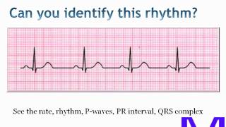 ECGEKG Electrocardiogram interpretation [upl. by Ynaffik79]