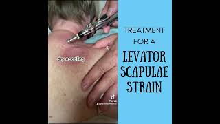 Treatment for Levator Scapulae Strain [upl. by Bissell]