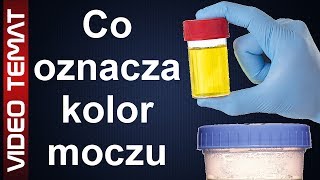 Co oznacza kolor moczu [upl. by Butta]