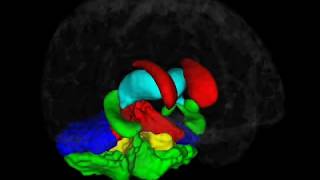 Brain Morphometry  Brain Image Analysis [upl. by Pyotr]