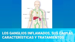 Los ganglios inflamados sus causas características y tratamientos [upl. by Camm]