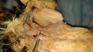 Cat Dissection Deep Muscles [upl. by Senhauser]