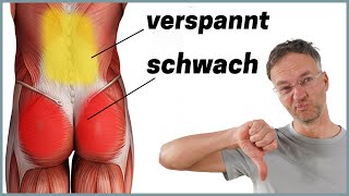 Die häufigste Ursache für Rückenschmerzen Anatomie erklärt [upl. by Salahcin]