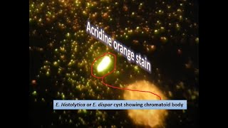 Acidine orange stained slide of chromatoid body of E histolytica or dispar [upl. by Mharba]