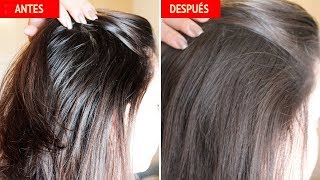 REMEDIO CASERO PARA CABELLO GRASO [upl. by Aiym]