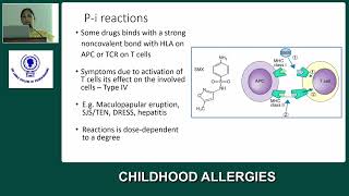 Childhood Allergies by Dr Dhanushka Dassanayake amp Professor P K Vedanthan [upl. by Lombardi474]