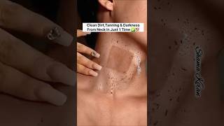 ✅️ Neck Cleaning Tips  Dark Neck Home RemediesTanning Removal Tips 😱beautyskincareshortsviral [upl. by Ydaf8]