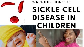 7 warning signs of sickle cell disease in children and babies [upl. by Rurik61]