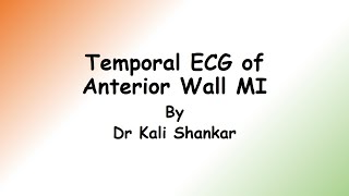 Management of Anterior Wall Myocardial InfarctionqRBBB [upl. by Lajes957]