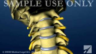 Cervical Spine and Intervertebral Disc Anatomy  Female Version [upl. by Einot516]