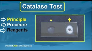 catalase test principle procedure microbiology  بالعربي labtech trendingshorts viralvideo [upl. by Egap]